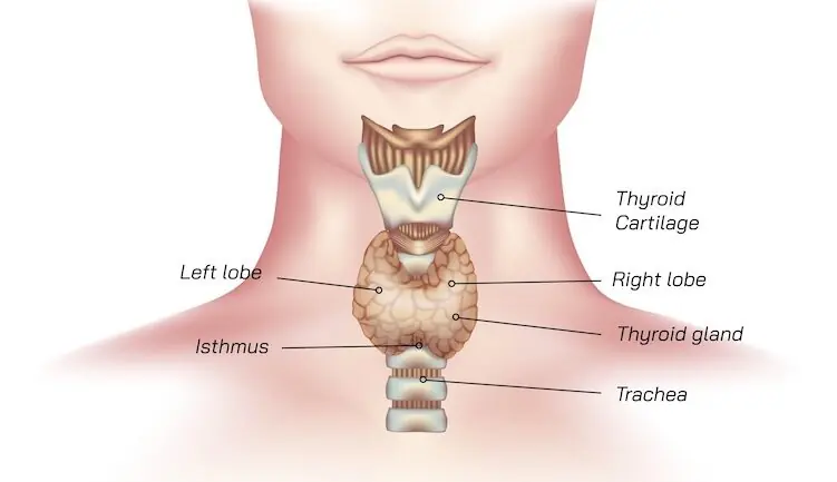 Thyroid Tissue damage 